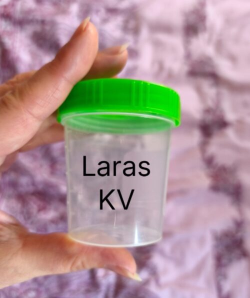 KV - Du möchtest, dass ich dir auf den Schwanz kacke?